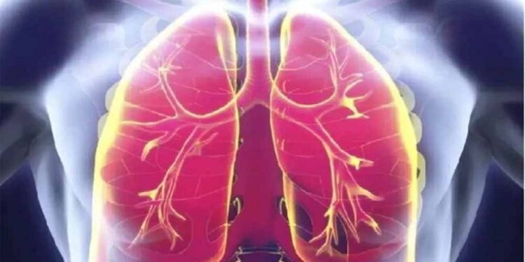 मध्य प्रदेश में ‘मेलिओइडोसिस’ का खतरा बढ़ा, लक्षणों से डॉक्टर भी हो रहे भ्रमित