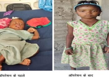 रायपुर : चिरायु योजना बच्चों के लिए भी बनी वरदान