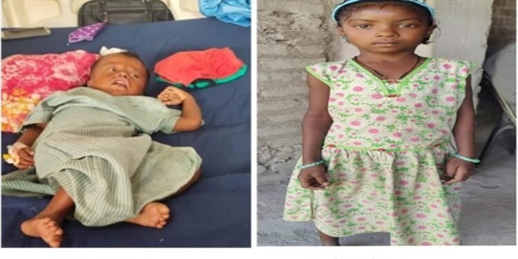 रायपुर : चिरायु योजना बच्चों के लिए भी बनी वरदान