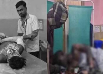 मंगल कार्बन प्लांट में भीषण ब्लास्ट: 9 माह के मासूम सहित 8 मजदूर झुलसे, हालत नाजुक