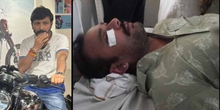 सतना में रोड टेंडर पर बवाल: हवाई फायरिंग के बाद पिस्टल की बट से हमला, CCTV खंगाल रही पुलिस