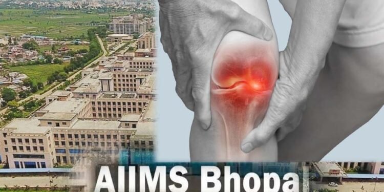 घुटनों के दर्द से मिलेगी परमानेंट मुक्ति, एम्स भोपाल और ग्वालियर आयुर्वेद संस्थान मिलकर खोजेंगे अचूक इलाज