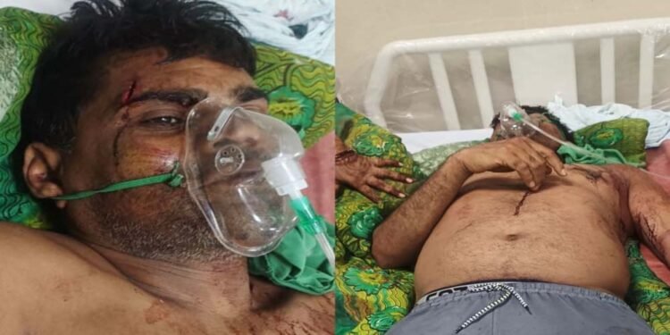 कुल्हाड़ी से हमला: गाली-गलौज का विरोध करने पर पूर्व जनपद सदस्य प्रतिनिधि पर जानलेवा वार