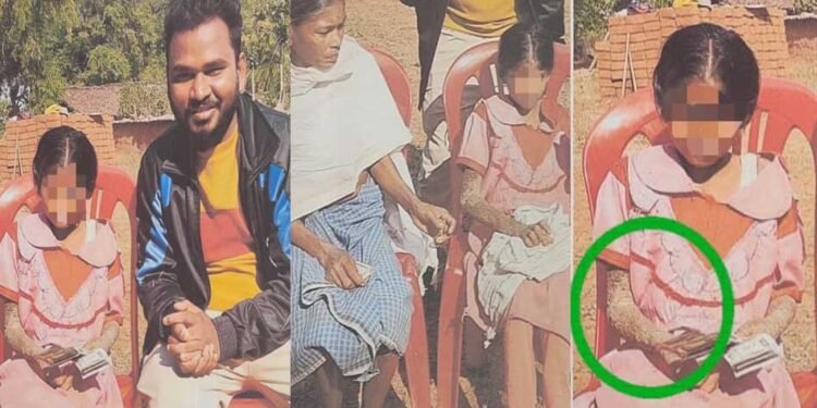 पत्थर शरीर वाली बच्ची के उपचार को लेकर बाल आयोग सक्रिय