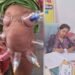 लोहरसी आयुर्वेदिक औषधालय में दर्द प्रबंधन हेतु कपिंग थेरेपी एवं विशेष आयुर्वेदिक उपचार सेवाओं का आरंभ