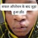 सफल सर्जरी से भीमे हेमला के चेहरे पर लौटी मुस्कान