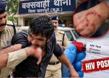 छतरपुर में रेप के आरोपी ने कांस्टेबल को काटा, मेडिकल जांच में HIV पॉजिटिव
