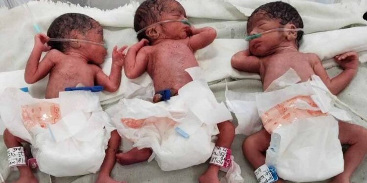 शहडोल में 10 मिनट के भीतर गूंजीं तीन किलकारियां, 20 साल की महिला ने दिया 3 बच्चों को जन्म