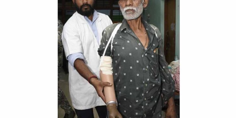 ट्रेन हादसे के दर्द पर ‘सेवा संकल्प’ का मरहम, धमतरी के तेजराम को दो घंटे में मिला कृत्रिम हाथ, लौटी जिंदगी की रंगत